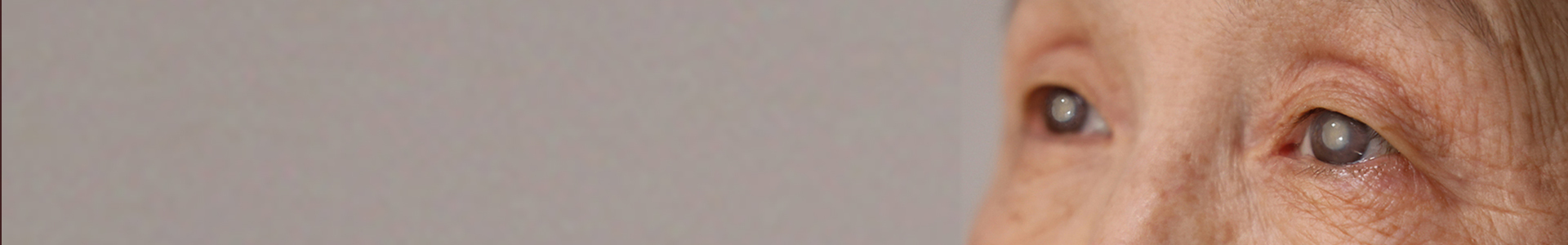 노안·백내장 