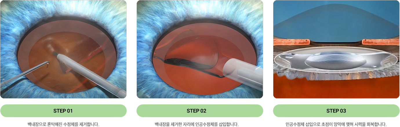 이미지명