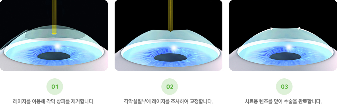 이미지명