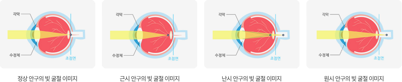 이미지명