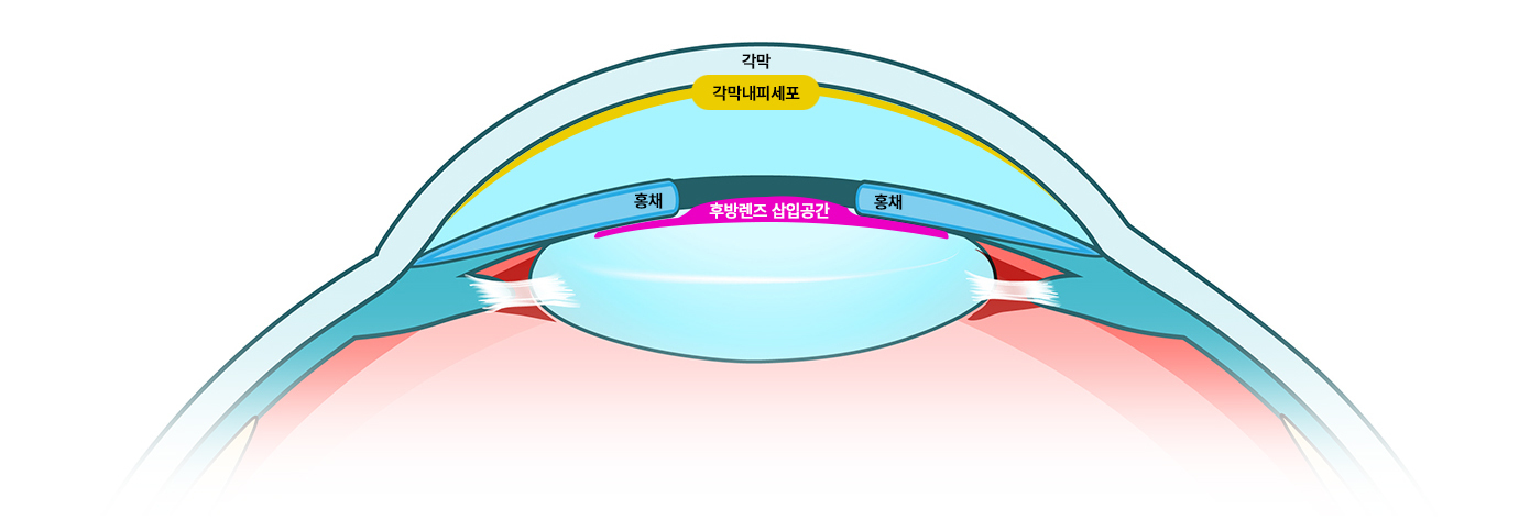 이미지명