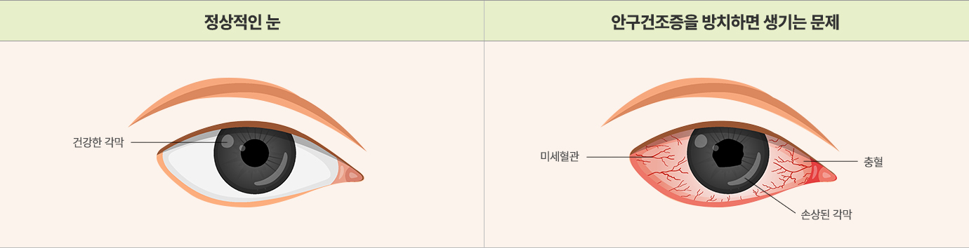 이미지명