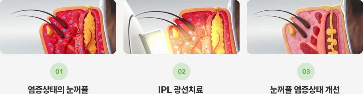 이미지명