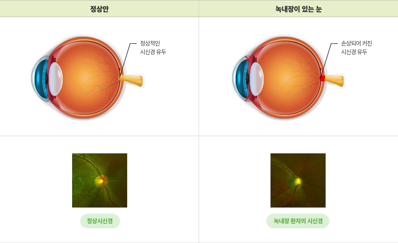이미지명