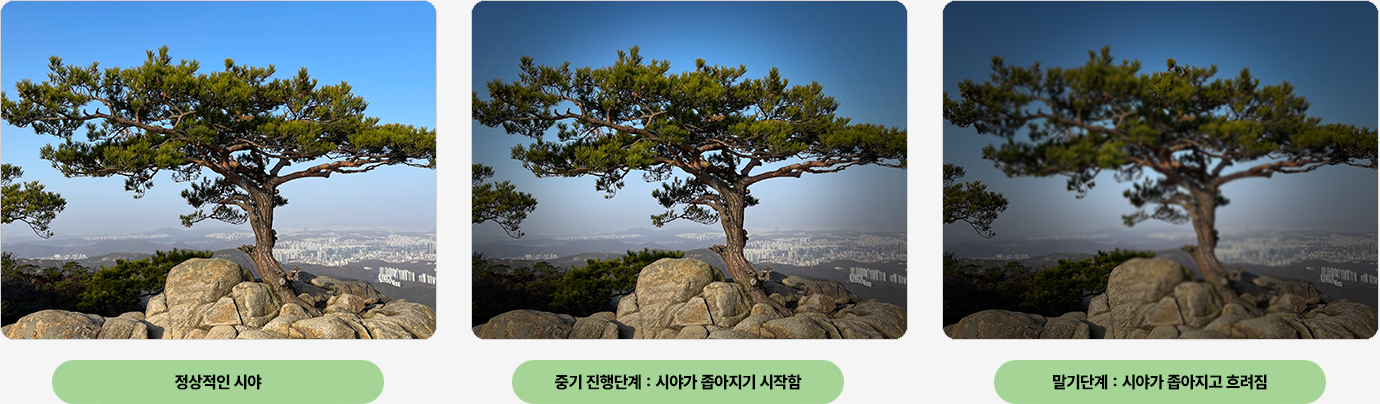 이미지명