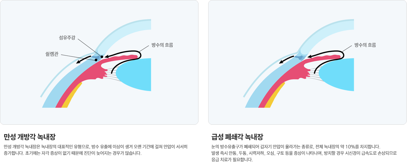 이미지명