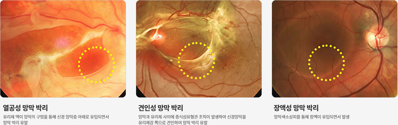 이미지명
