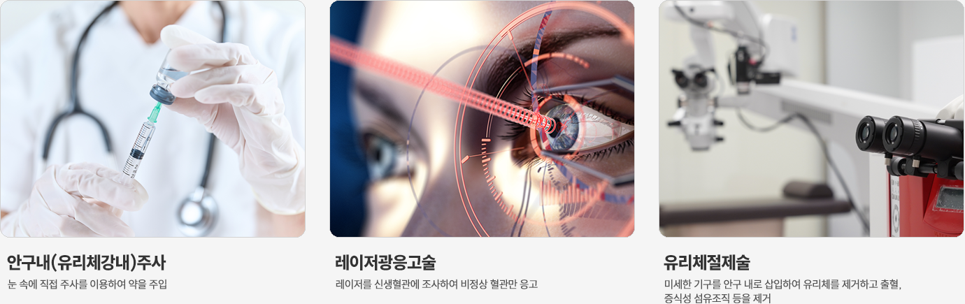 이미지명