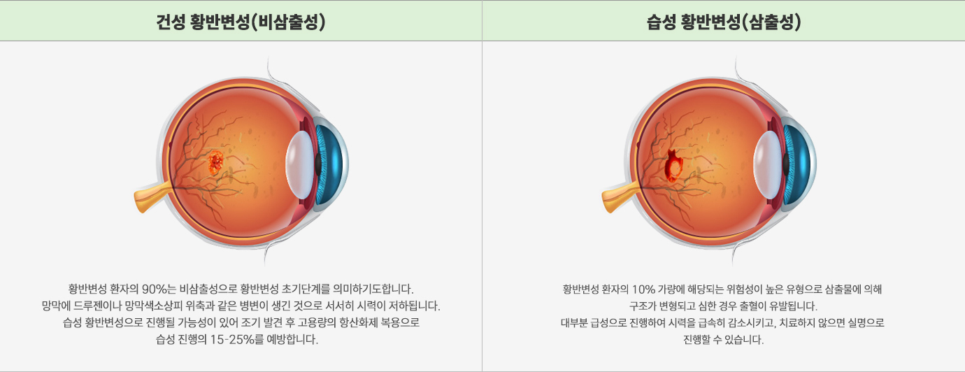 이미지명
