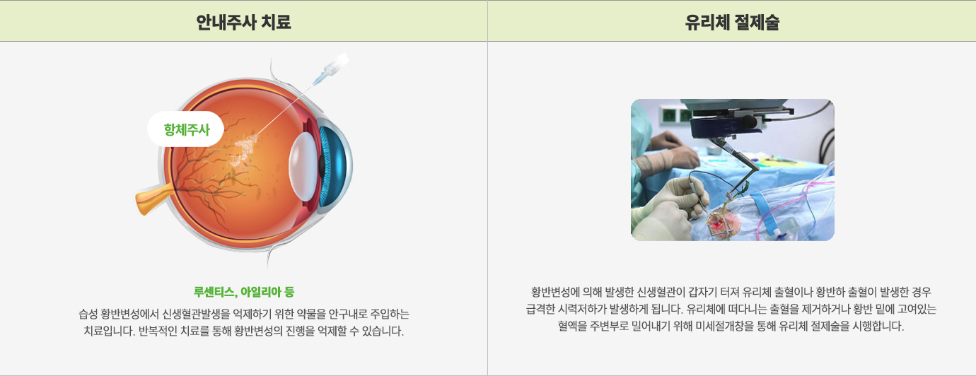 이미지명