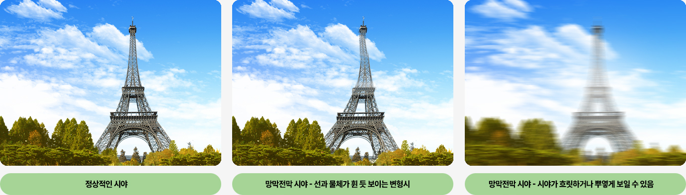 이미지명