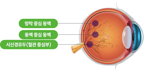 이미지명