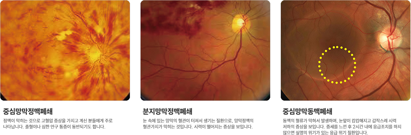 이미지명