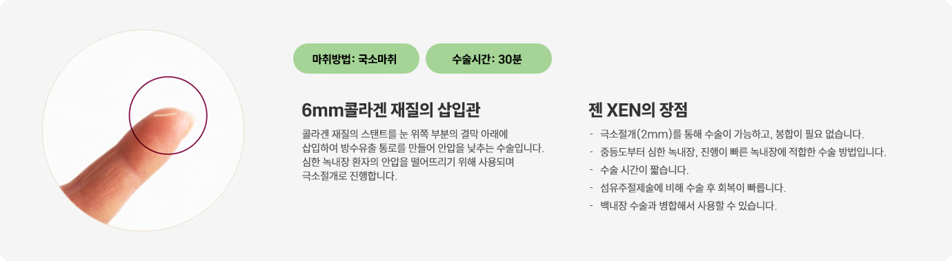 이미지명