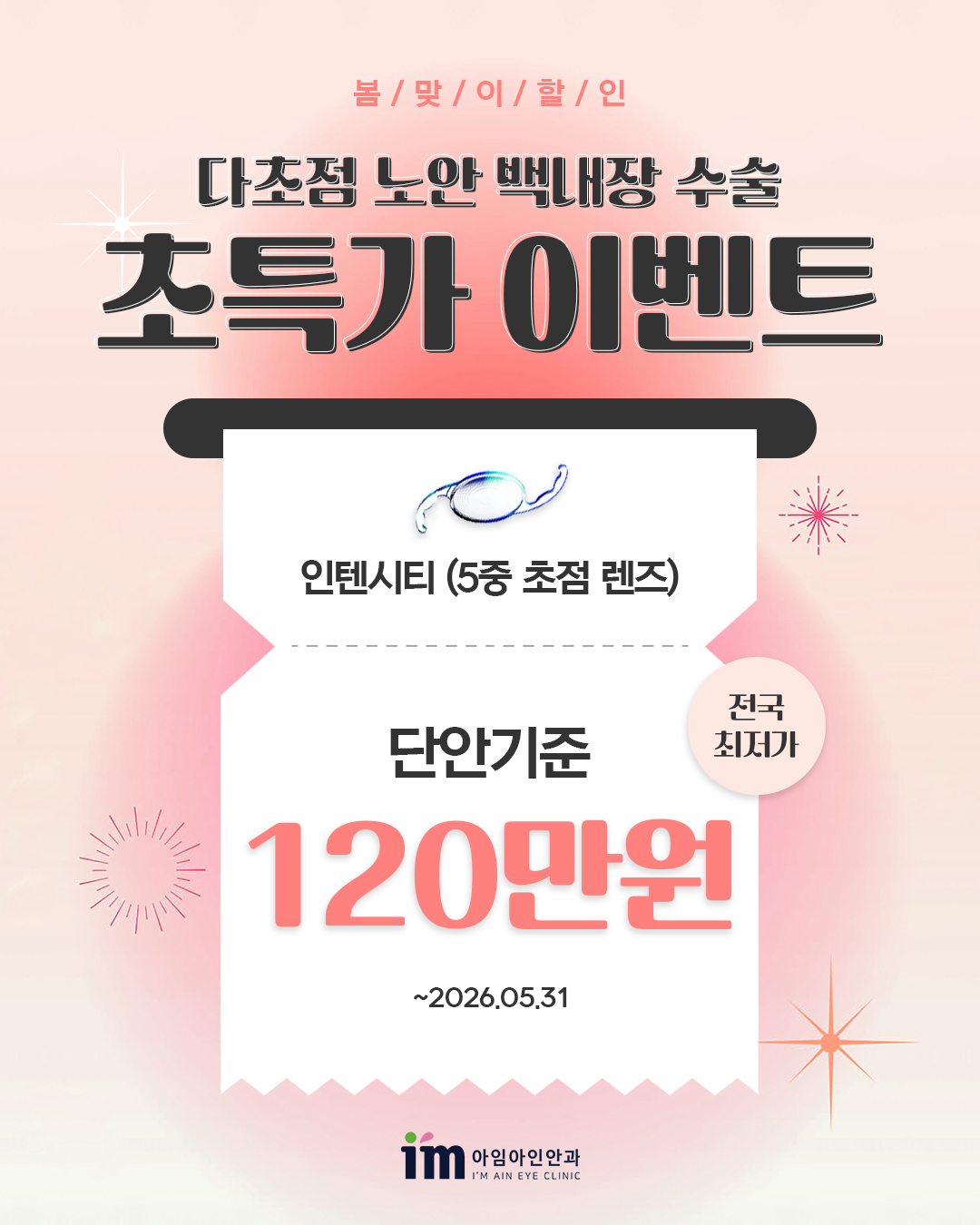 백내장 이벤트
